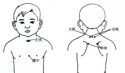 天突大椎膻中位置图图片