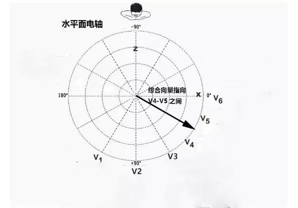 心电轴范围图片