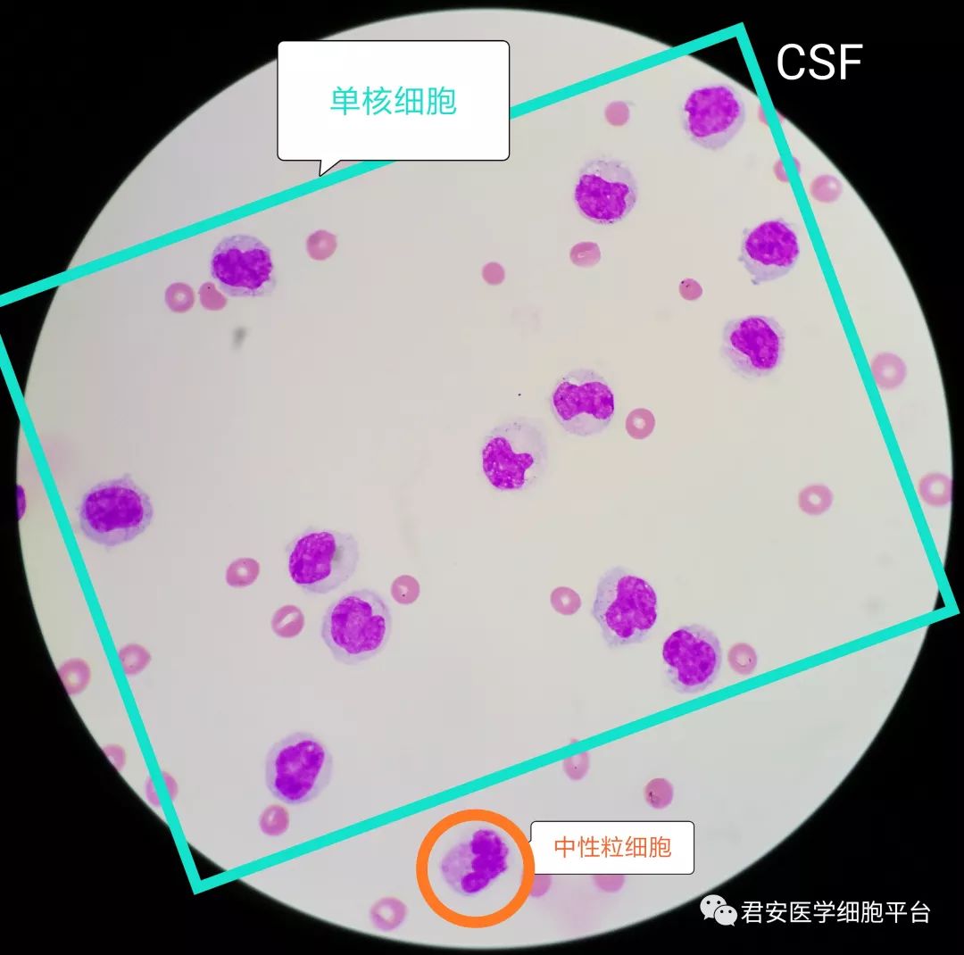 巨噬细胞he染色图片
