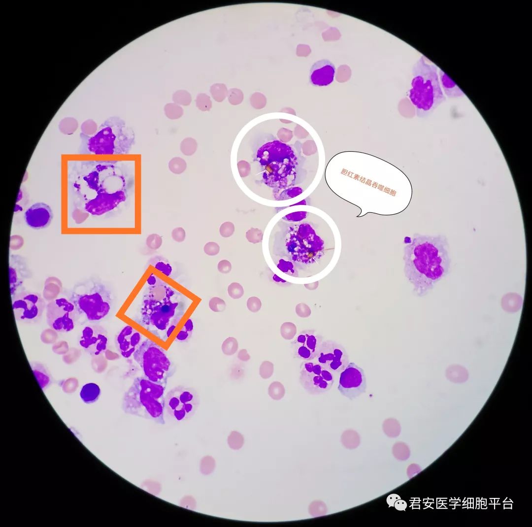 单核细胞 显微镜图片