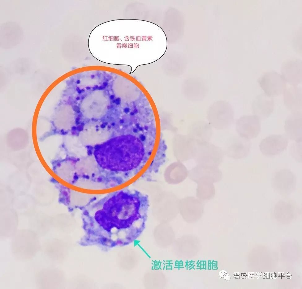 单核吞噬细胞系统图片