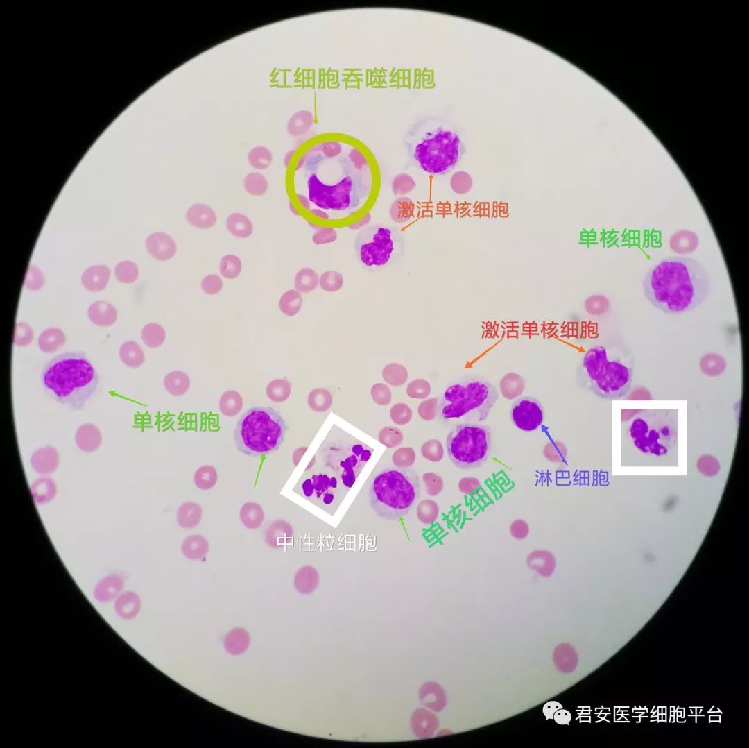 单核巨噬细胞绘图图片