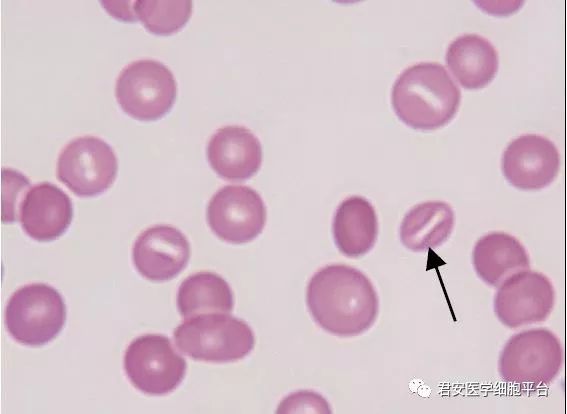 口形红细胞图片图片