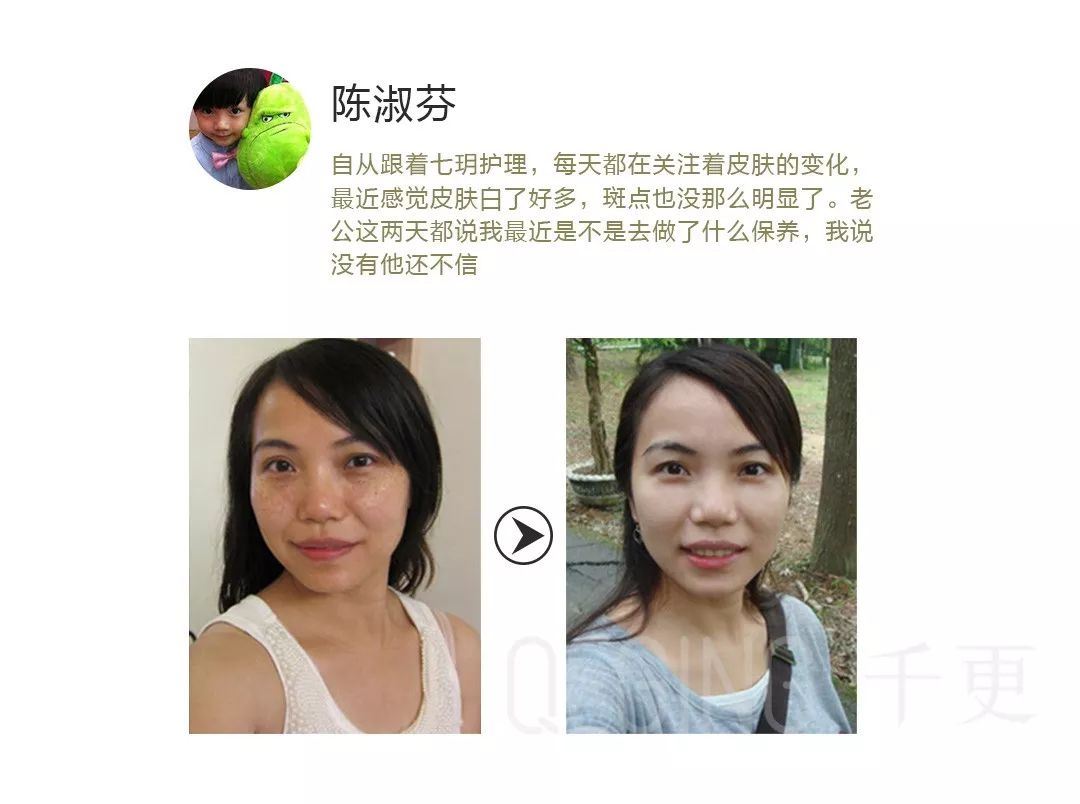 每個長斑的女人都想淡斑,但並不是每個女人都會去做,因為淡斑並不容易