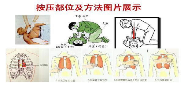 心肺复苏位置图片