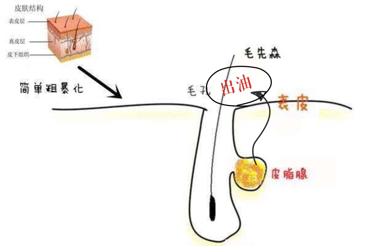 脸上出油是经由皮脂腺细胞分泌的油,即游离皮脂,是皮脂腺内成熟的细胞