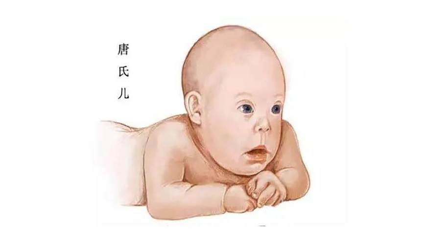 新生儿草鞋足图片