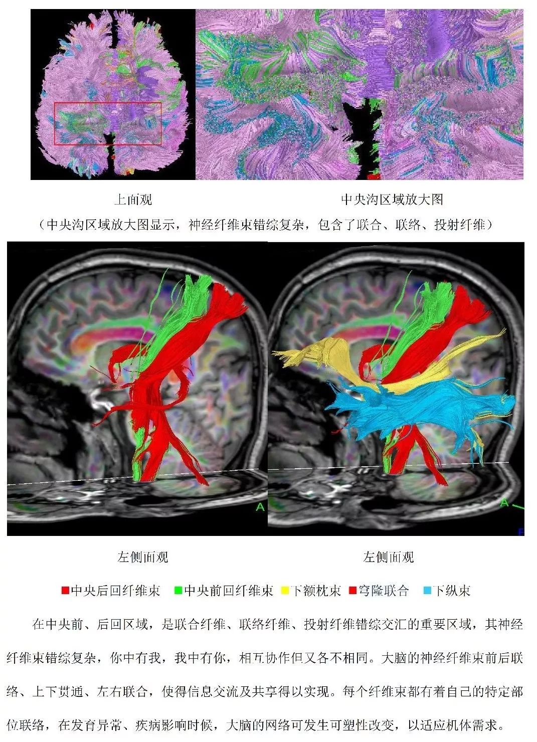 神经纤维束纵切图片