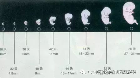 超聲波並不會影響胎兒出生以後的體格以及智力的發育