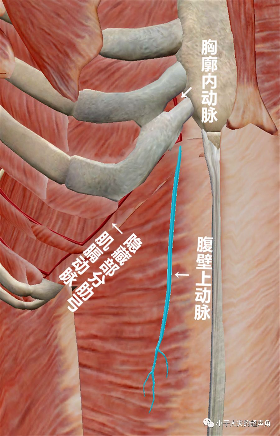 图8:胸廓内动脉远端移行为腹壁上动脉和肌膈动脉,前者继续下行于腹直