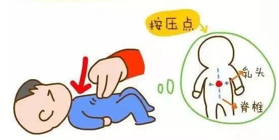 儿童腹部按压抢救图片