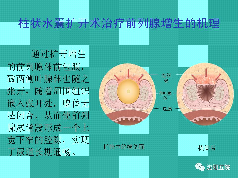 【健康科普】關愛男性健康 從