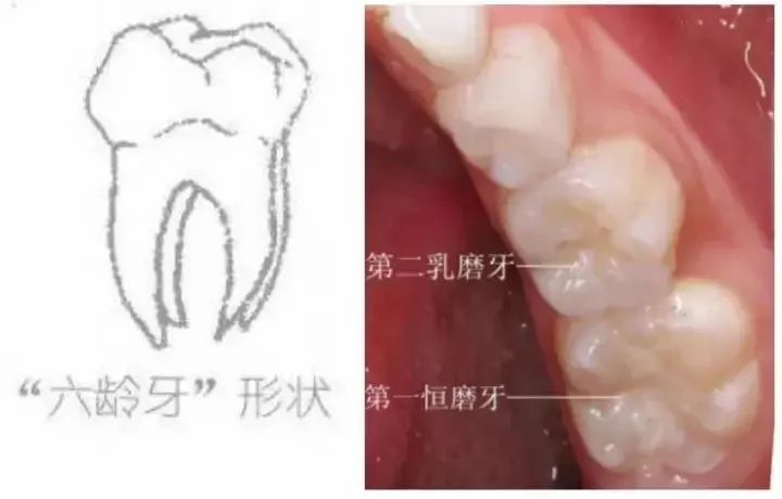 第二乳磨牙图片图片