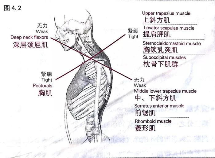 肩颈的大板筋图解图片