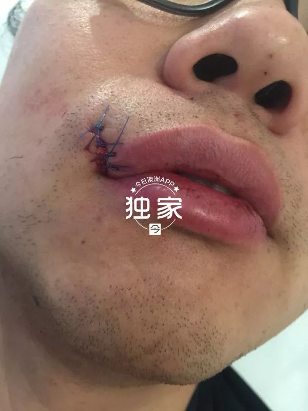 他們叫囂捅死我們強姦我還想燒店臥龍崗華人及留學生