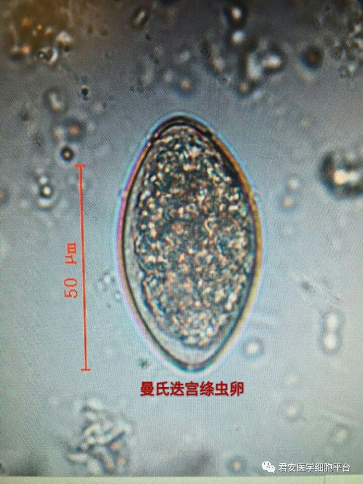 缩小膜壳绦虫卵图片