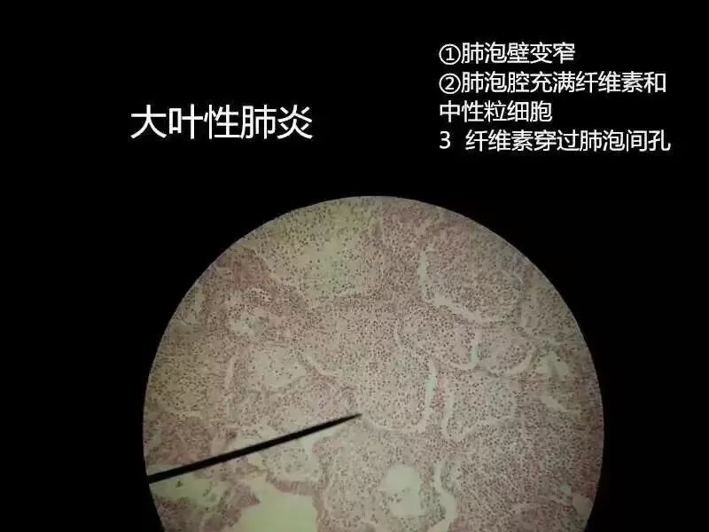 病理学切片库