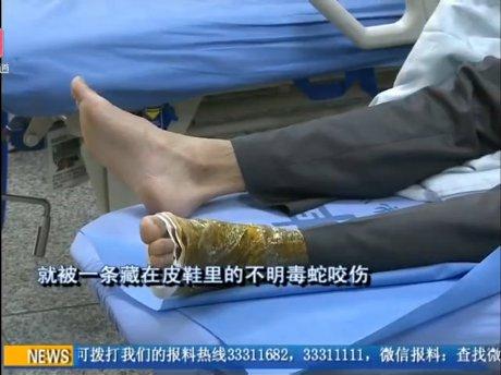 深圳男子被鞋内毒蛇咬脱了一看脚上有2个洞
