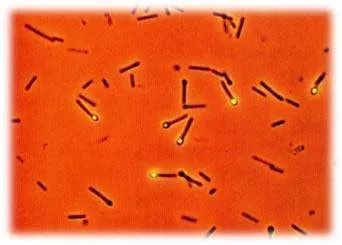 破伤风杆菌,学名革兰氏阳性厌氧芽胞杆菌,其芽胞对外界环境的抵抗力