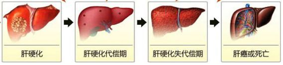 肝病患者吃甜食會加劇病情應多吃這2物可抑制受損肝細胞病變