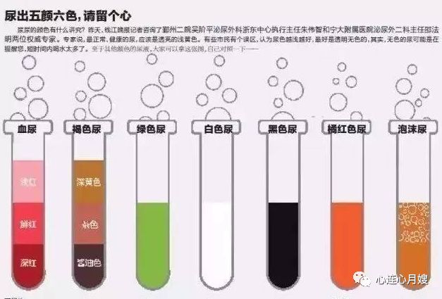 寶寶尿液有5種顏色,最危險的是這2種!爸媽仔細看!