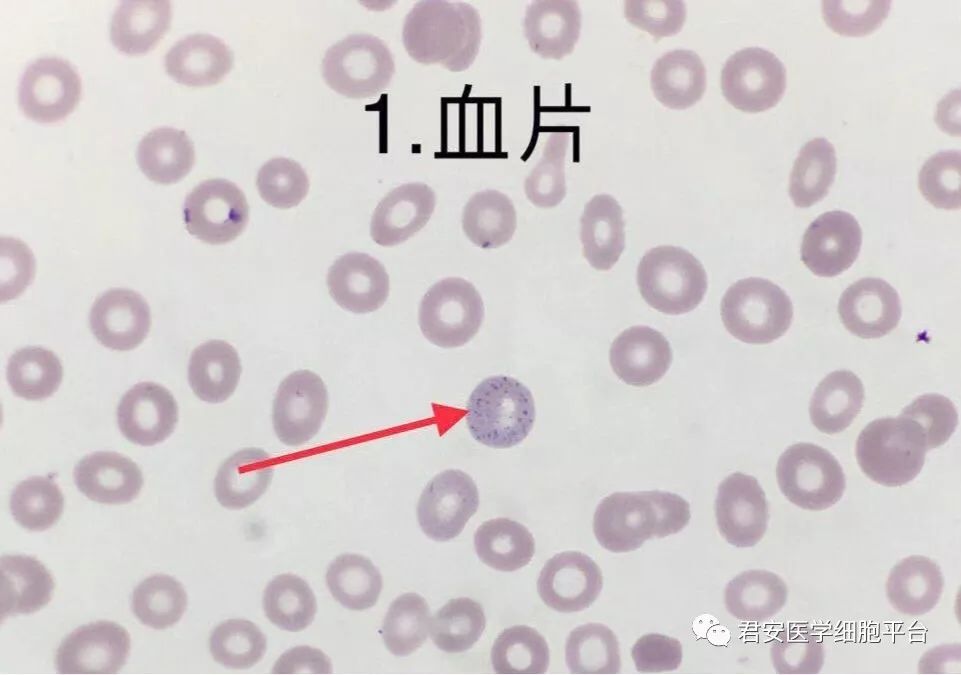 嗜碱性粒细胞的形态图片