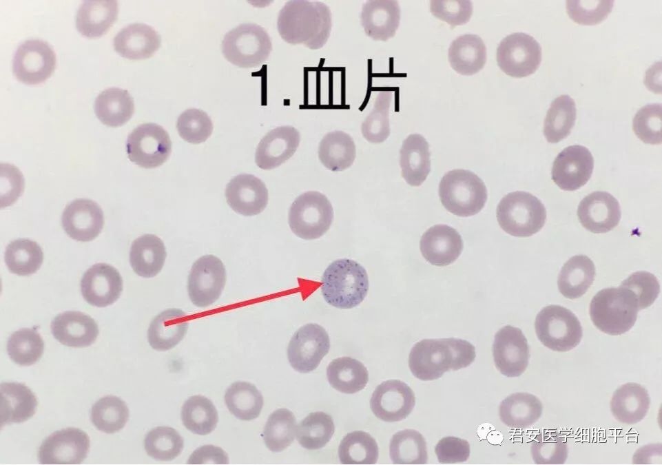 嗜碱性粒细胞形态图片图片