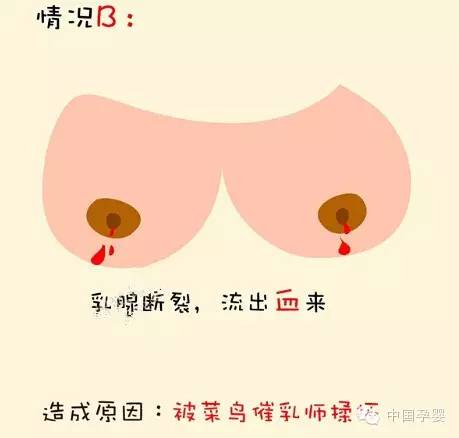 乳房那些不为人知的秘密,美女们要看哦!