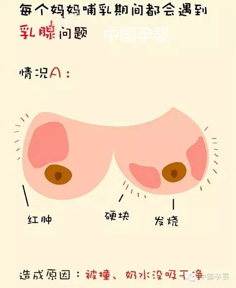 乳房那些不为人知的秘密,美女们要看哦!