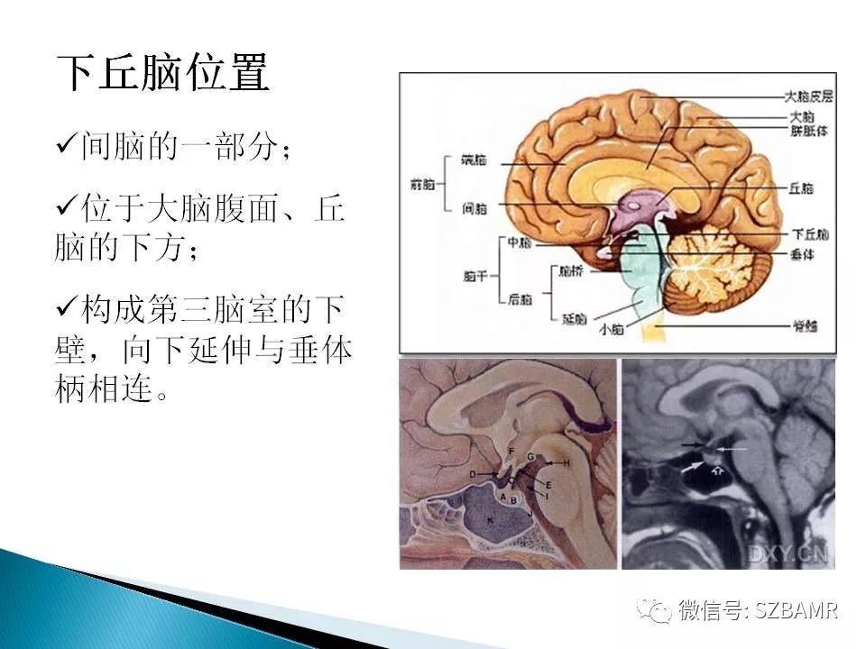 下丘脑分区图片