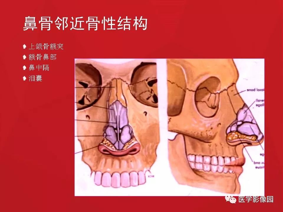 鼻梁骨骨骼图片