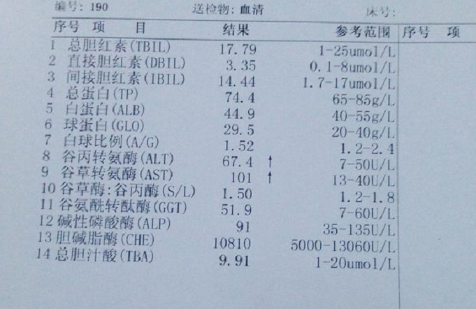 轉氨酶高怕是肝炎要惡化2種植物磨粉沖水喝10天降酶防肝癌