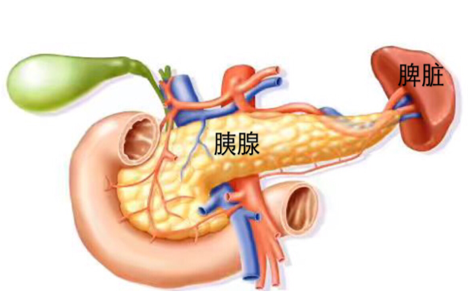 老人上腹胀痛不适,胰腺长肿瘤,手术难度太大或难保脾脏?