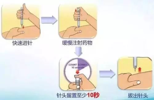 医学科普看过来正确注射胰岛素的九个步骤