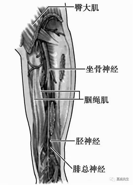 小老黑 什么是腰椎管狭窄症和坐骨神经痛