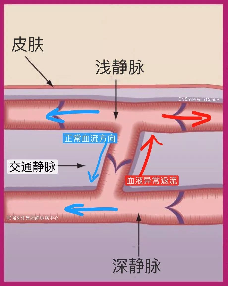 静脉流向图图片