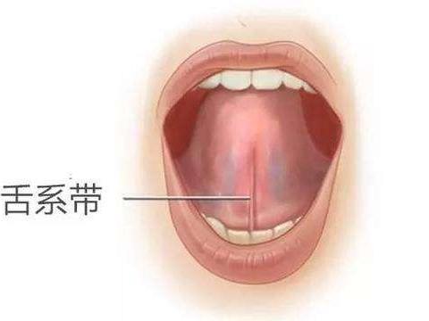 舌头筋短图片