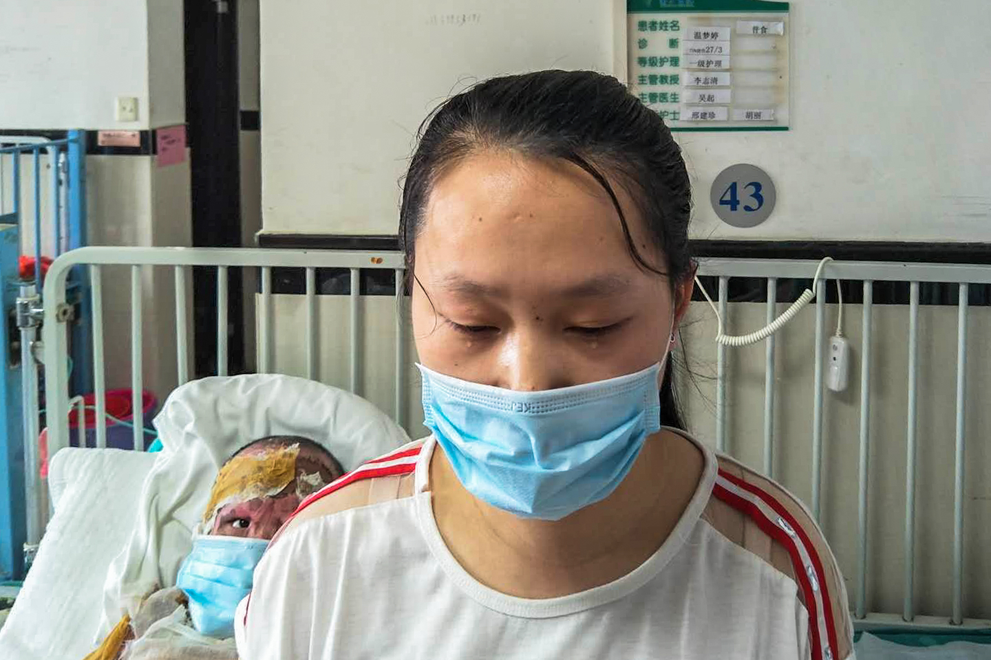 18岁烧伤女孩救助图片