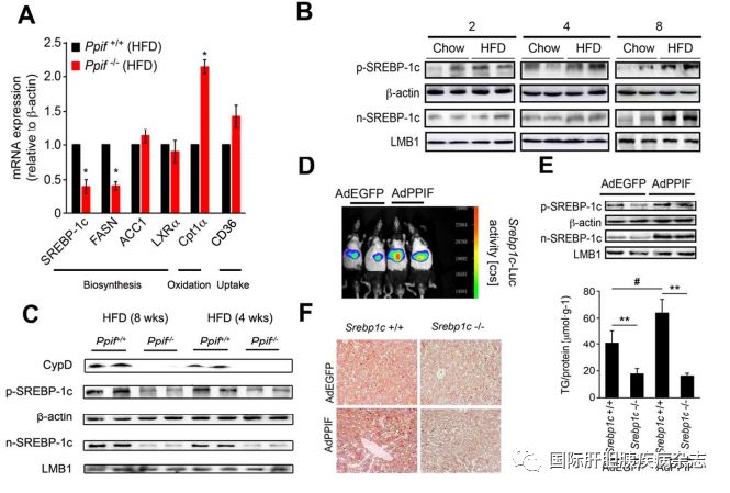 hepatology丨中國學者揭示肝脂肪變性新機制