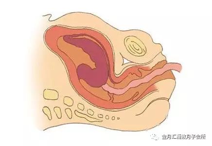 圖解寶寶經過產道的整個過程