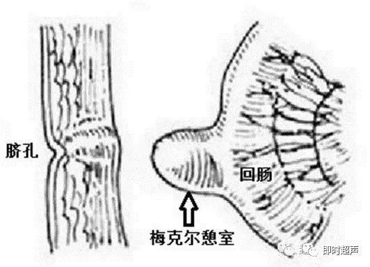 梅格尔憩室图片