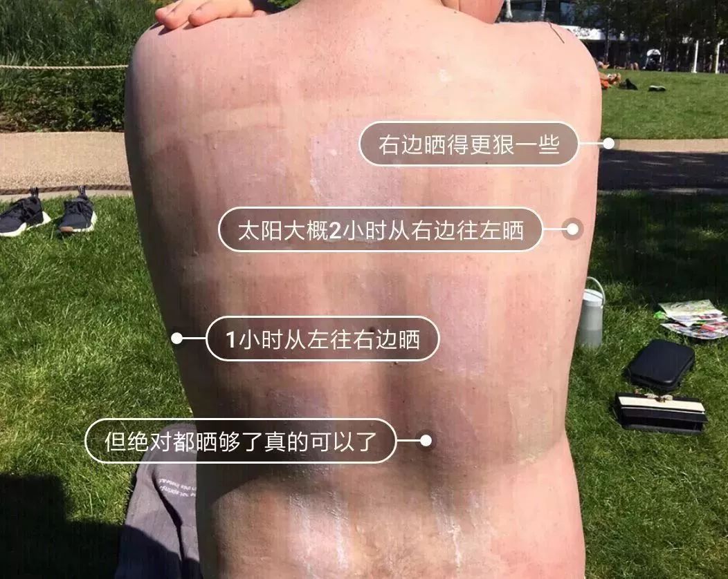 你有你的防晒霜,我有我的医美嫩肤,安排?