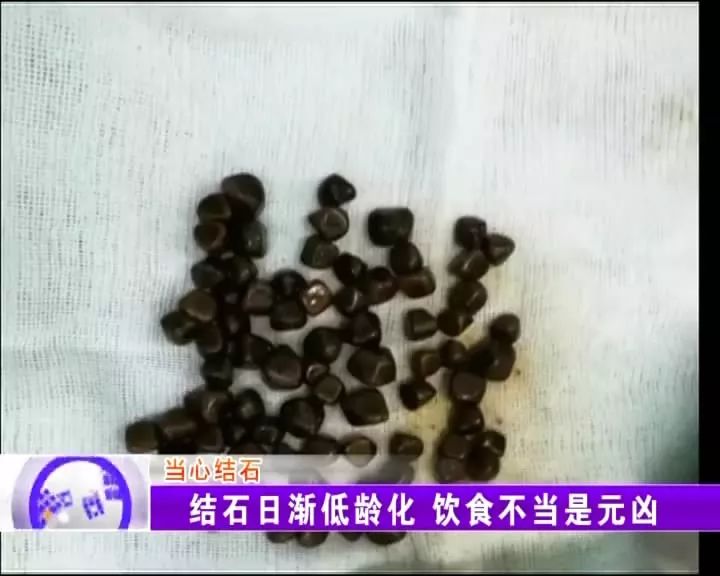 桓臺父母注意啦2歲男童竟患上尿道結石只因