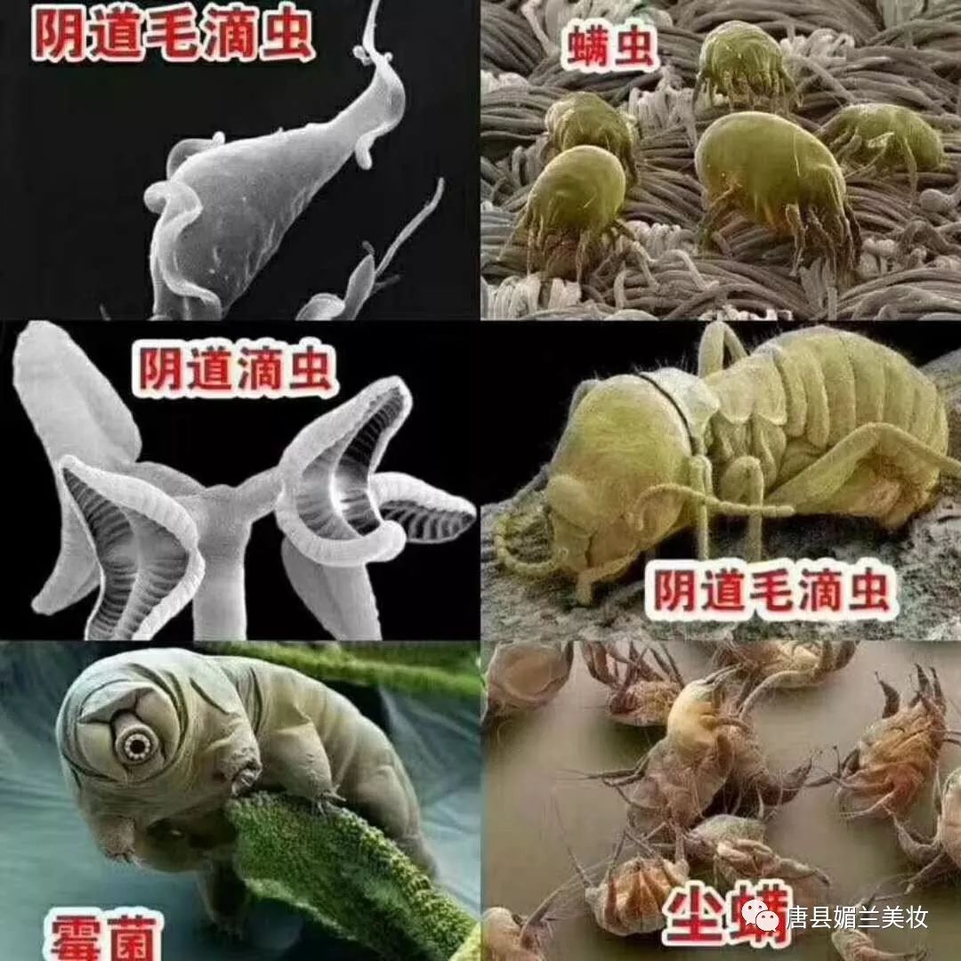 不癢才怪呢717171你看到的流出一點白色豆腐渣就是幾萬只黴菌