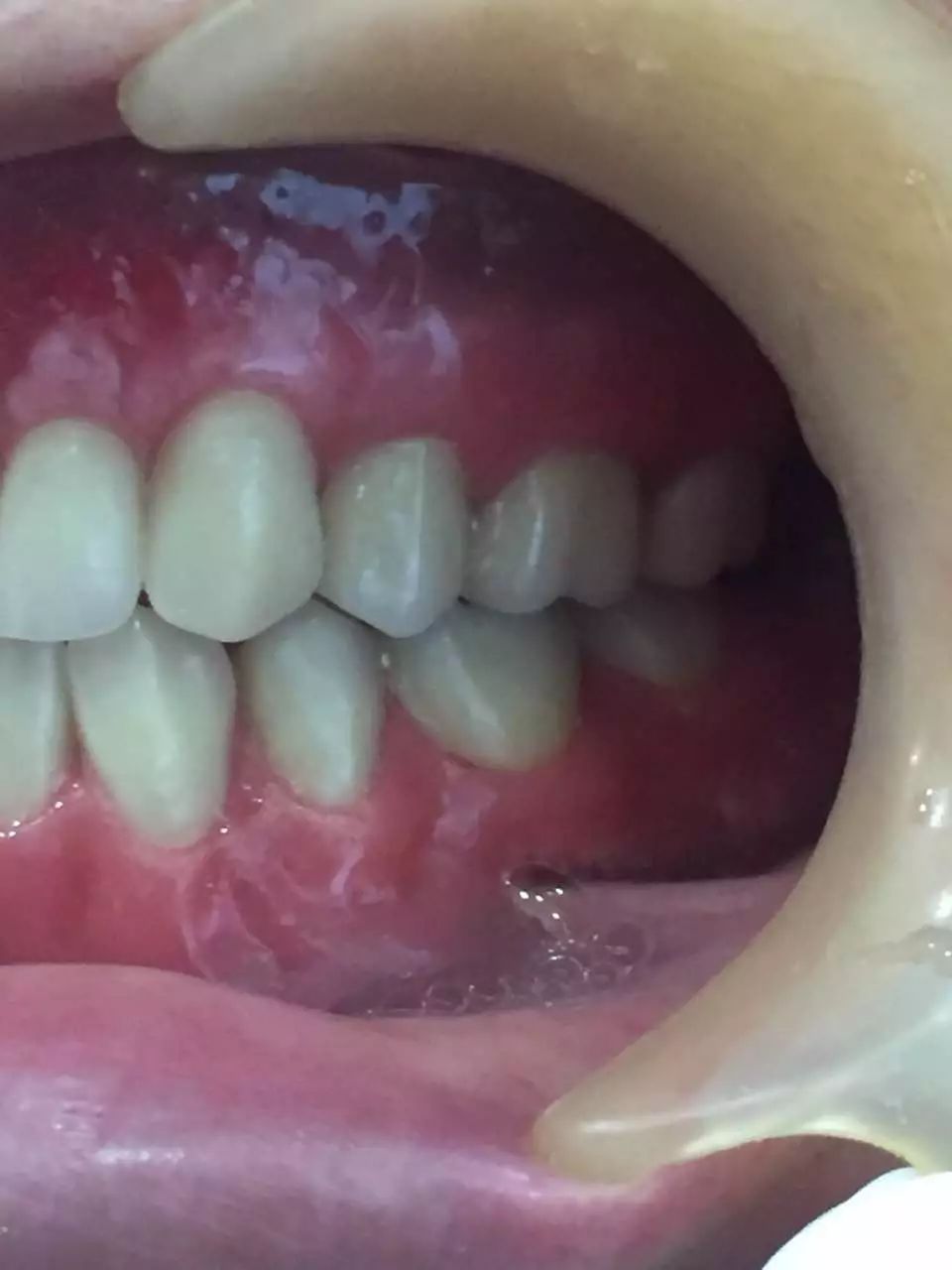 技师课程建立与牙医师之临床排牙沟通深圳站