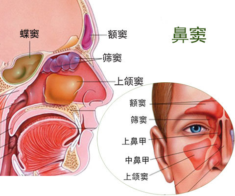 额窦气化图片