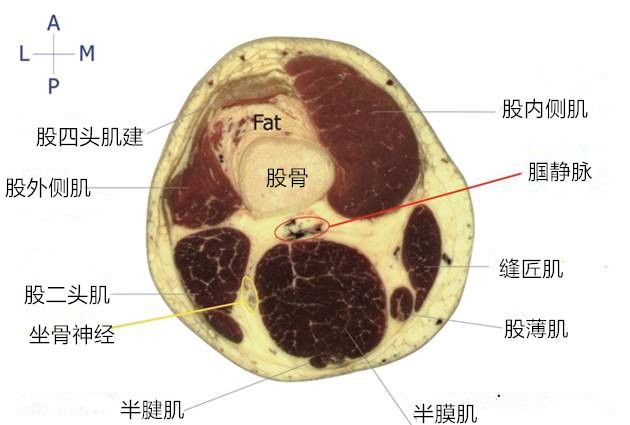 大腿横断面解剖图图片