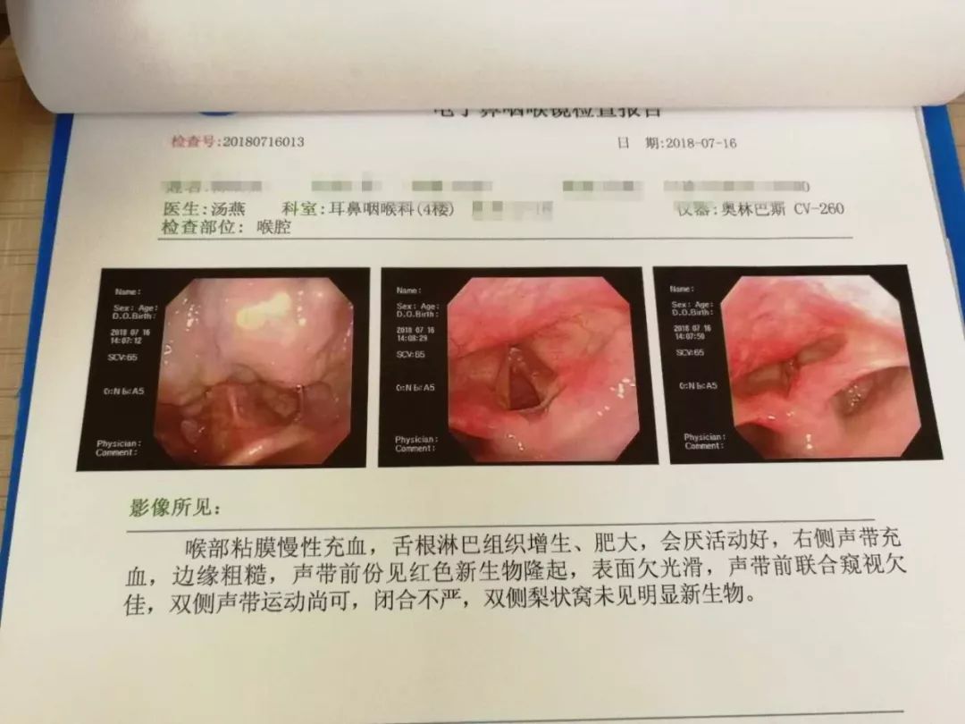 咽喉癌图片 症状图片