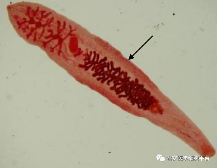 請報告圖片中箭頭所指對象的名稱2017402肺吸蟲(蟲卵)(大小約為100μm