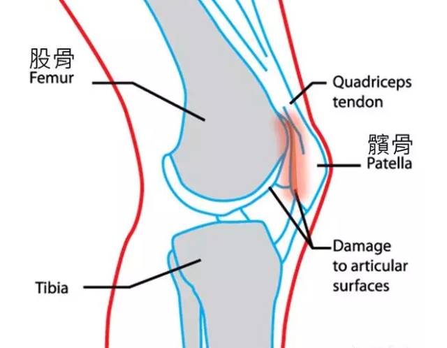 膝盖疼图片结构图图片